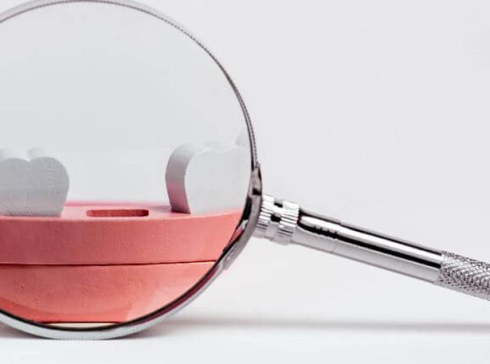 Hypohidrotic Ectodermal Dysplasia: A Comprehensive Guide to Rare Tooth Development Conditions