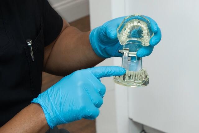 Dental Implants